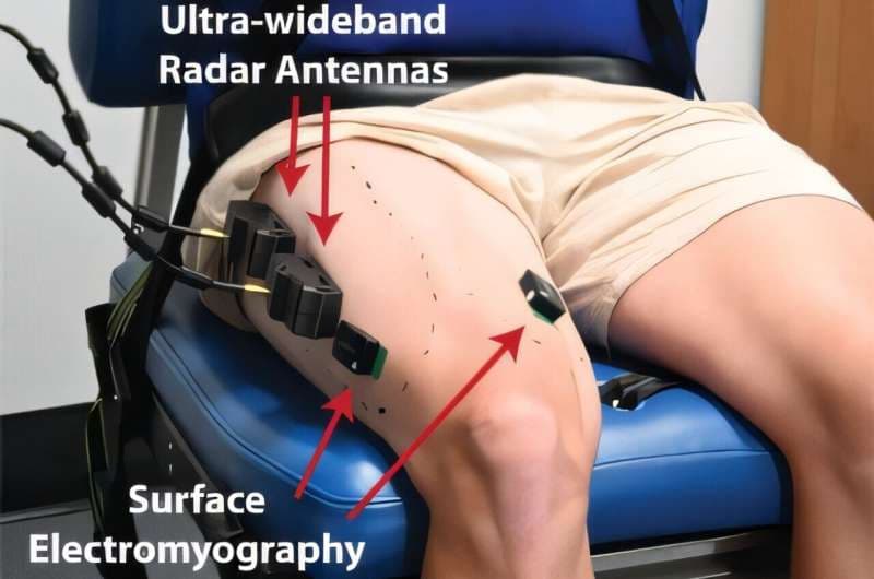 Muscle radar unlocks potential for future robotic limbs